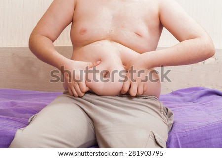 Boy 11 years metabolic disorder. belly child obese patients.child suffer from being overweight. childhood obesity