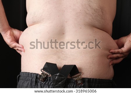 Big belly obese men. Disease and metabolic disorders.