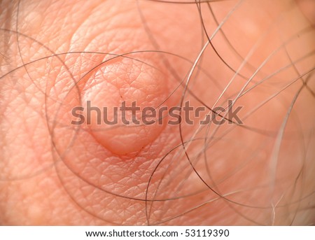 Macro shot of skin texture and male human nipple with hair