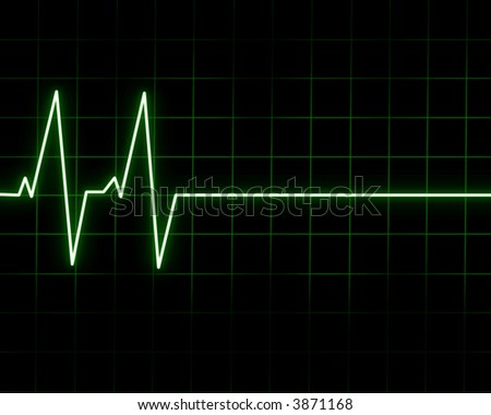 Heart beat on heart monitor