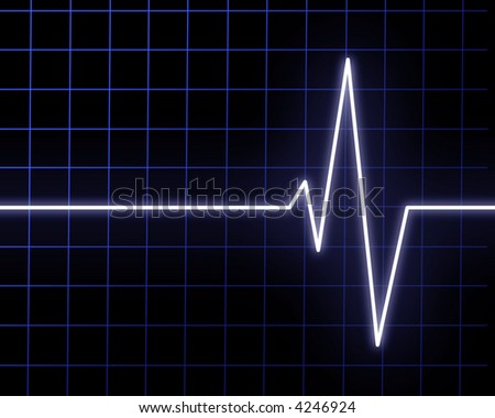 Heart beat on hospital monitor