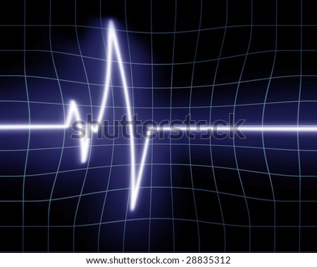 Heart beat on clinic monitor on a dark background