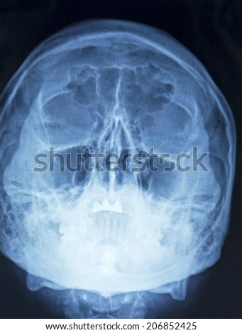 Film x-ray human\'s head, top view