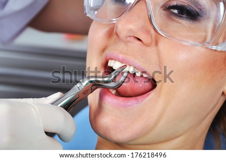 girl at dentist  hold extraction to remove patient tooth