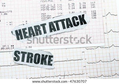 heart attack diagram. heart attack diagram.