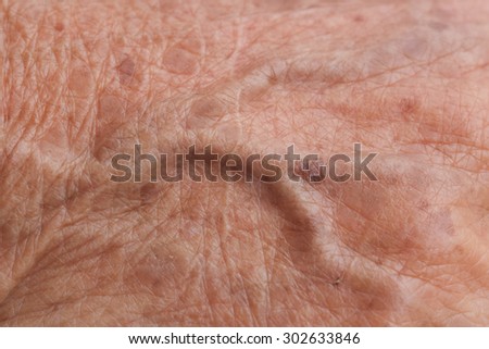 old woman skin blood vessel