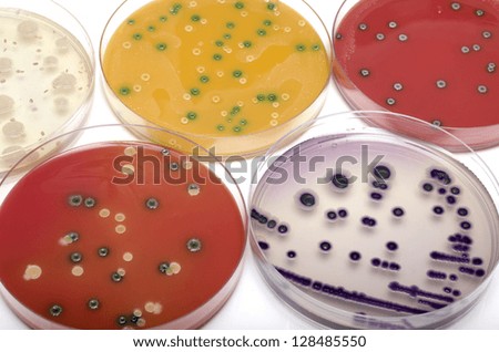 Bacterial plates top view Bacterial plates top view
