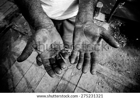 Worker is showing his chapped hands, dirty and injured palms.