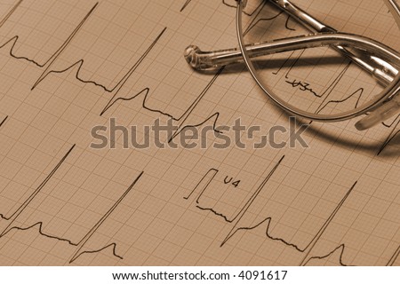 heartbeat trace and Glasses macro