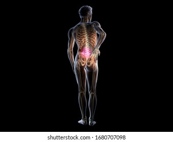 3d Illustration Showing Painful Lumbar Spine Stock Illustration