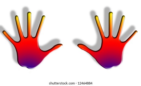 Radiogram Hand Xray Roentgenogram Vector Illustration Stock Vector