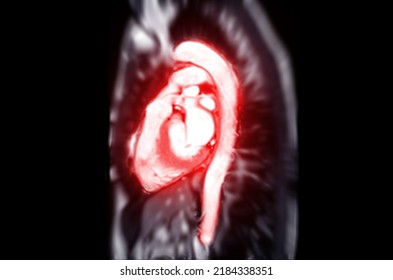 Mri Heart Cardiac Mri Magnetic Resonance Stock Illustration 2184338351