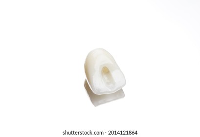 Anterior Implant Crown Images Stock Photos Vectors Shutterstock