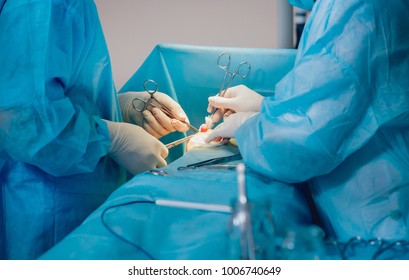 Surgeon Performs Endoscopic Microdiscectomy Herniated Intervertebral