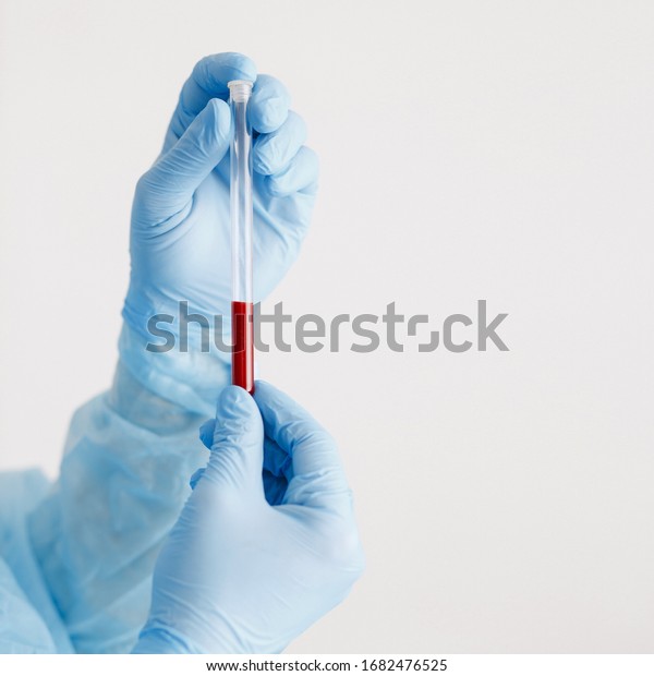 Close Doctor Hand Holding Blood Sample Stock Photo