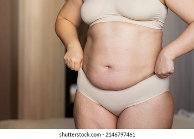 Cropped Image Overweight Fat Woman Stomach Stock Photo Shutterstock