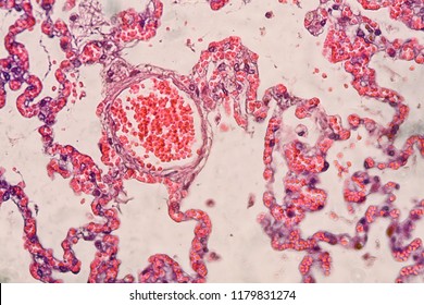 Cross Section Lung Tissue Hematoxilin Eosin Shutterstock