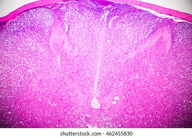 Cross Section Spinal Cord Stock Photo Shutterstock