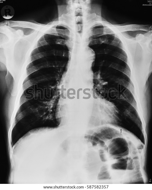 Ct Whole Abdomen Front View Stock Photo Shutterstock