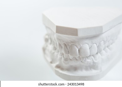 Dental Casting Gypsum Model Plaster Cast Stock Photo 243013498