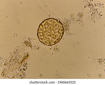 Egg Ascaris Lumbricoides Roundworm Human Stool Stock Photo