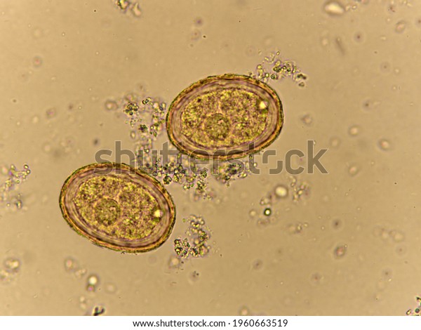 Egg Ascaris Lumbricoides Roundworm Human Stool Stock Photo 1960663519