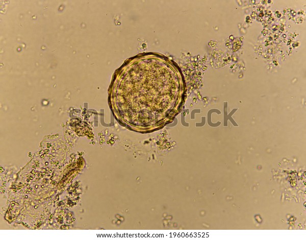 Egg Ascaris Lumbricoides Roundworm Human Stool Stock Photo 1960663525