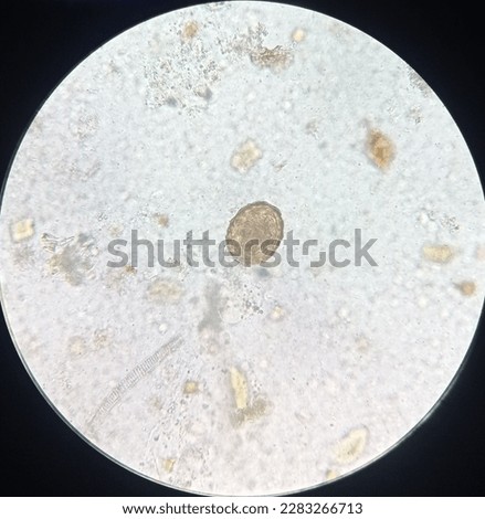 Free Lumbricoides Stock Photos Stockvault Net