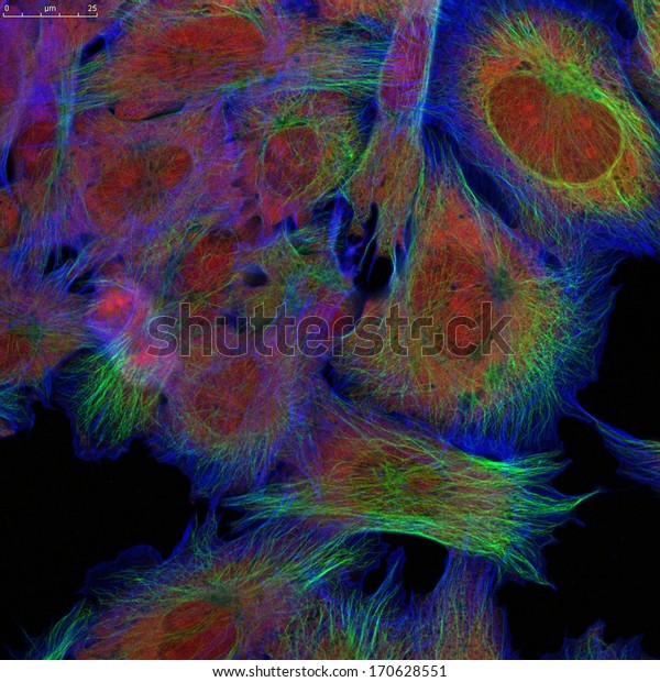 Fibroblasts Skin Cells Labeled Fluorescence Dyes Stock Photo 170628551