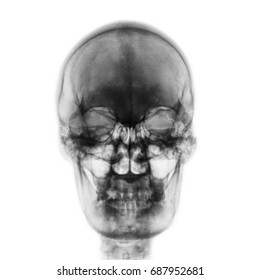 Film Xray Normal Human Skull On Foto Stok 687952681 Shutterstock