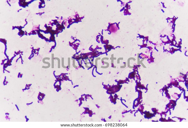 Gram Staining Called Grams Method Method Stock Photo