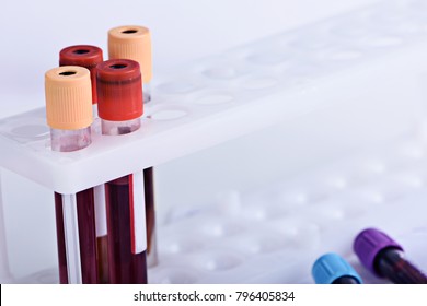 Hematology Blood Analysis Report Collection Tubes Stock Photo 796405834