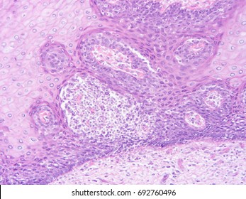 Histology Human Salivary Gland Tissue Show Stock Photo 692760496