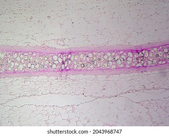 Histology Image Showing Hyaline Cartilage Perichondrium Stock Photo