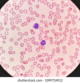 Human Blood Smear Under X Light Stock Photo Shutterstock