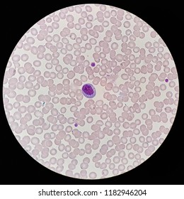 Human Blood Smear Under X Light Stock Photo Shutterstock