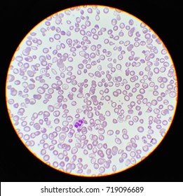 Human Blood Smear Under X Light Stock Photo Shutterstock