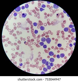 Human Blood Smear Under 100x Light Foto Stok 753044947 Shutterstock