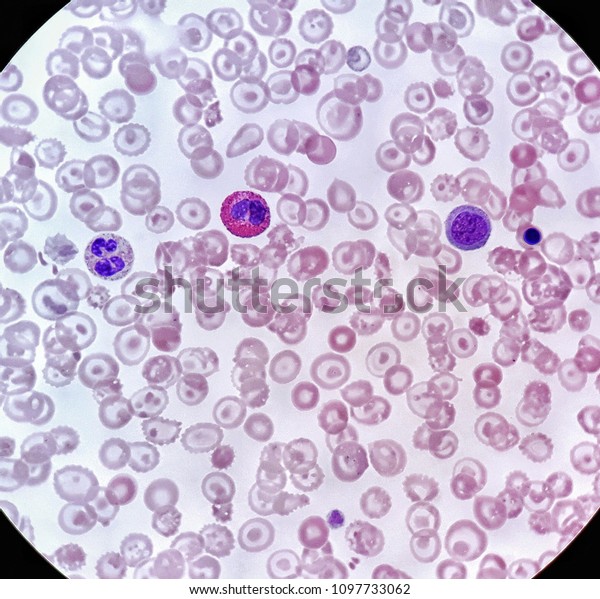 Human Blood Smear Under X Light Stock Photo Edit Now