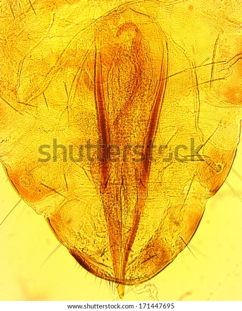 Human Louse Pediculus Humanus Abdomen Permanent Stock Photo 171447695