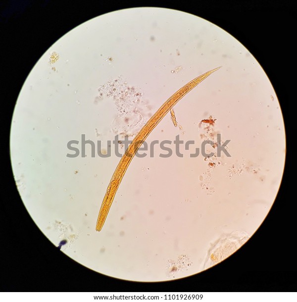 Human Parasite In Stool Under X Light Microscopy Strongyloides