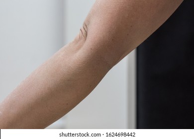 Hypermobility Known Doublejointedness Describes Joints That Stock Photo
