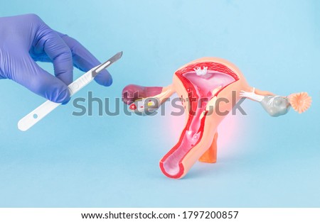 VAGINAL OPERATIONS Stock Photos And Images Avopix