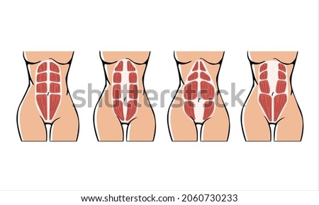 Diastasis Stock Vector Images Avopix