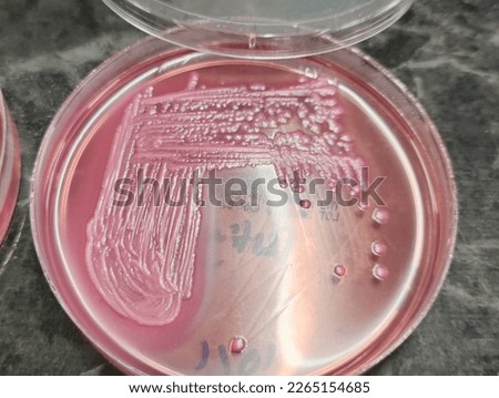 ESCHERICHIA COLI ON MACCONKEY AGAR Stock Photos And Images Avopix