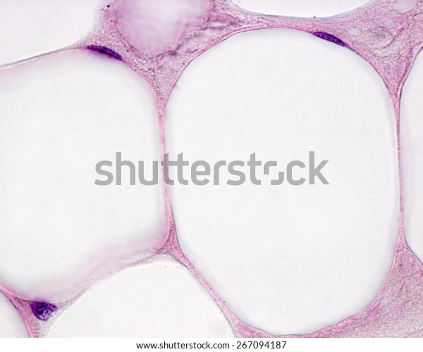 Light Micrograph Showing Two White Adipocytes Stock Photo 267094187