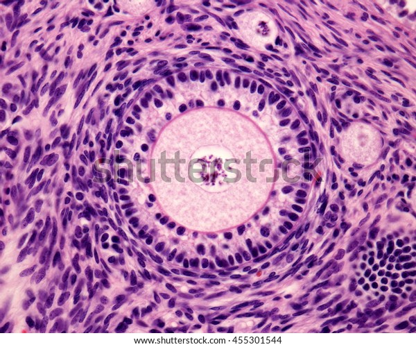 Light Microscope Micrograph Ovary Primary Follicle Stock Fotografie