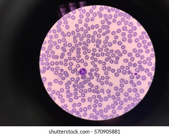 Стоковая фотография 1336548680 Eosinophil Cat Blood Smear Under