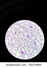 Eosinophil Cat Blood Smear Under