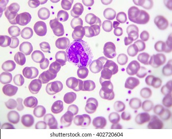 Monocyte Cell White Blood Cell Peripheral Foto Stock Editar Agora